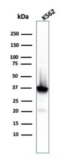 NPM1 Antibody (rNPM1/1901) - Azide and BSA Free, Novus Biologicals 100 &mu;g | Buy Online | Novus Biologicals | Fisher Scientific